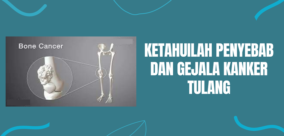 Ketahuilah Penyebab dan Gejala Kanker Tulang